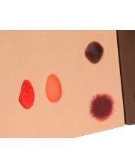 Stadi diversi di ulcera da pressione Erler Zimmer R10167