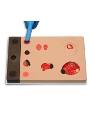 Stadi diversi di ulcera da pressione Erler Zimmer R10167