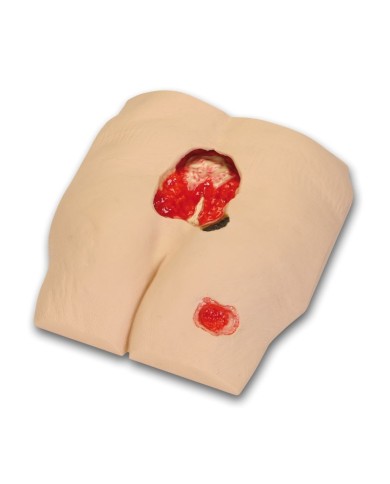 Simulatore di ulcera da decubito al IV stadio Erler Zimmer R10172