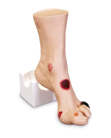 Simulatore di piede con ulcere Wilma Erler Zimmer R10227