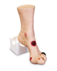 Simulatore di piede con ulcere Wilma Erler Zimmer R10227