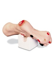 Simulatore di piede con ulcere Wilma Erler Zimmer R10227