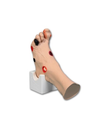 Simulatore di piede con ulcere Wilma Erler Zimmer R10227