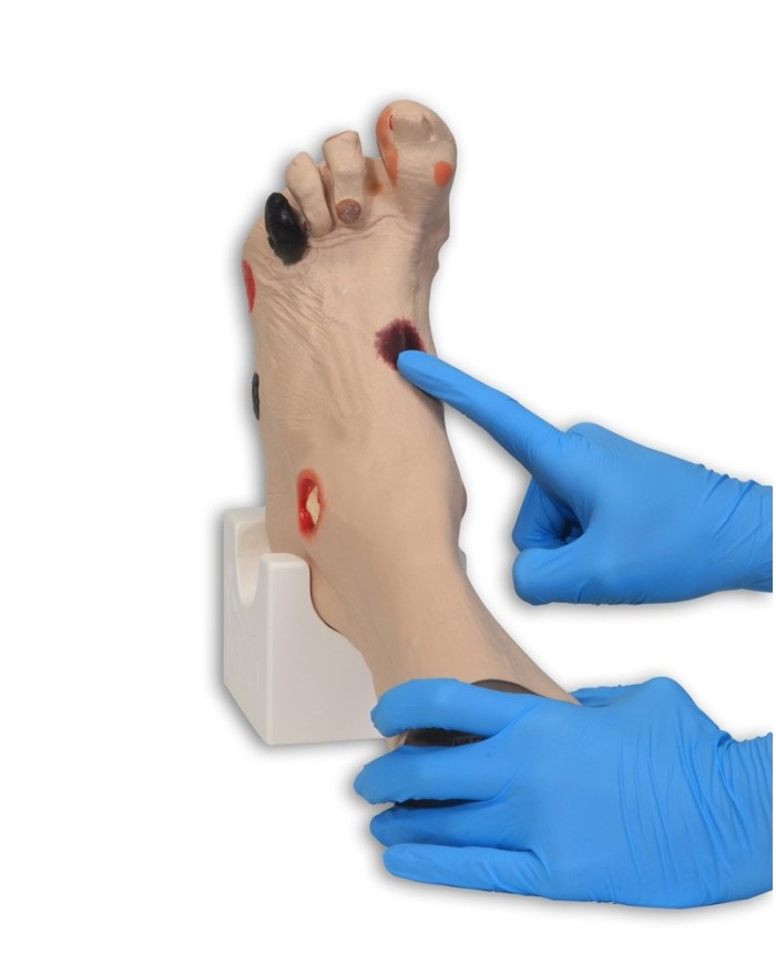 Simulatore di piede con ulcere Wilma Erler Zimmer R10227