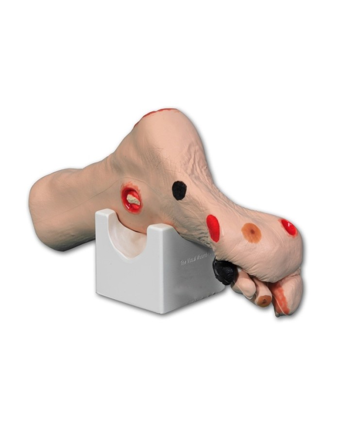 Simulatore di piede con ulcere Wilma Erler Zimmer R10227