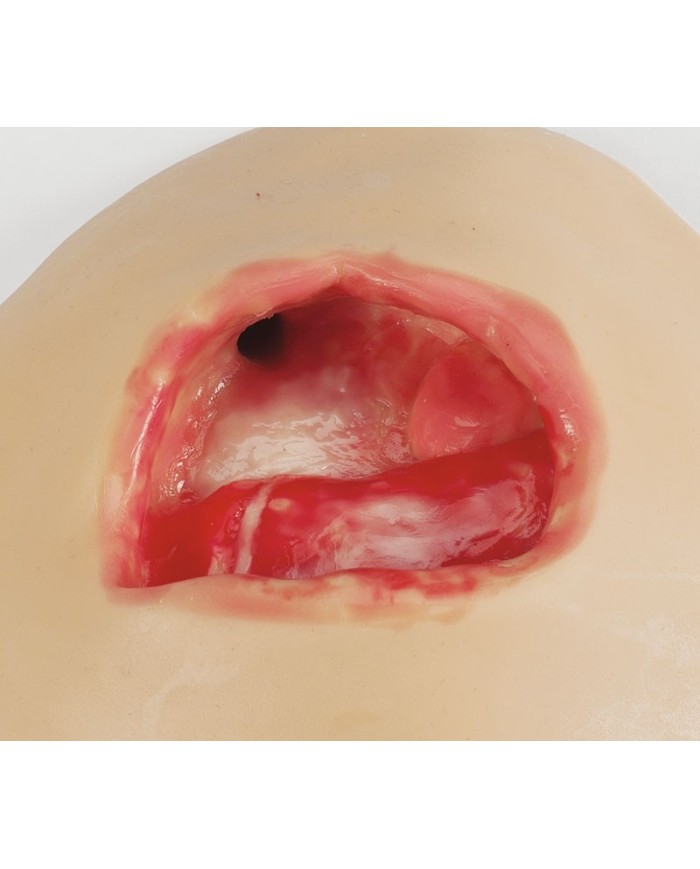 Simulatore per la terapia a pressione negativa NPWT Erler Zimmer R11011