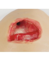 Simulatore per la terapia a pressione negativa NPWT Erler Zimmer R11011