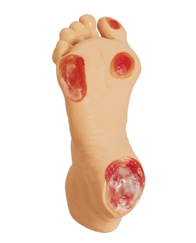 Simulatore di piede geriatrico con ulcere Erler Zimmer R10228
