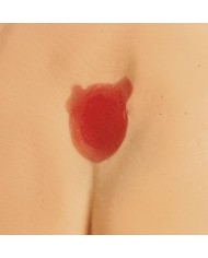 Modelli di ulcere da decubito e piaghe da decubito Erler Zimmer R11047