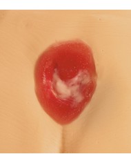 Modelli di ulcere da decubito e piaghe da decubito Erler Zimmer R11047