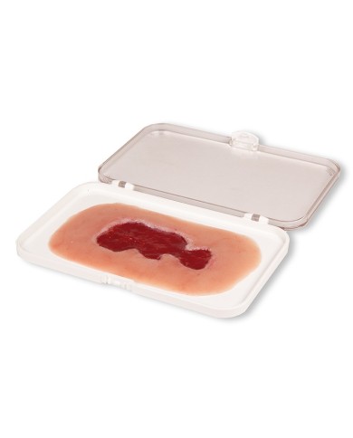 Moulage di ferita da ulcera venosa della gamba piccola in fase di granula