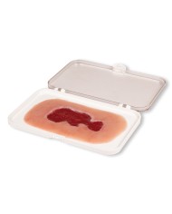 Moulage di ferita da ulcera venosa della gamba piccola in fase di granula