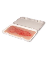 Moulage di ferita da ulcera venosa degli arti inferiori ampia in fase di 