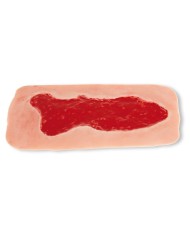 Moulage di ferita da ulcera venosa degli arti inferiori ampia in fase di 