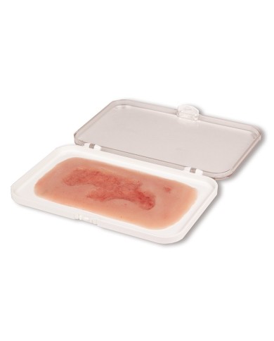 Moulage di ferita da ulcera venosa degli arti inferiori piccola in fase d