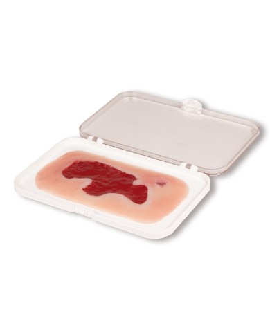 Moulage di ferita da ulcera arteriosa degli arti inferiori piccola in fas