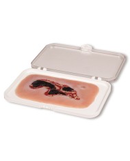 Moulage di ferita da ulcera arteriosa degli arti inferiori piccola in fas