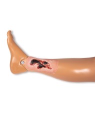 Moulage di ferita da ulcera arteriosa degli arti inferiori piccola in fas