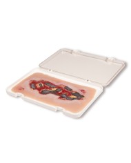 Moulage di ferita da ulcera arteriosa degli arti inferiori grande in fase