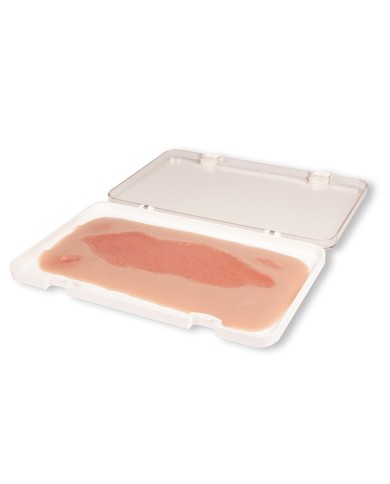 Moulage di ferita da ulcera arteriosa degli arti inferiori grande in fase