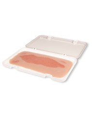 Moulage di ferita da ulcera arteriosa degli arti inferiori grande in fase