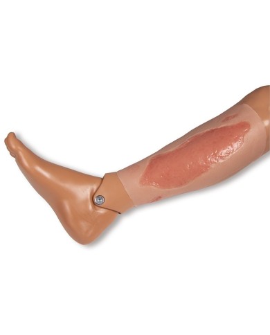 Moulage di ferita da ulcera arteriosa degli arti inferiori grande in fase