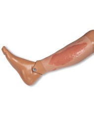 Moulage di ferita da ulcera arteriosa degli arti inferiori grande in fase