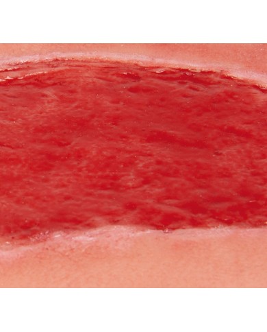 Moulage di ferita da ulcera arteriosa degli arti inferiori grande in fase