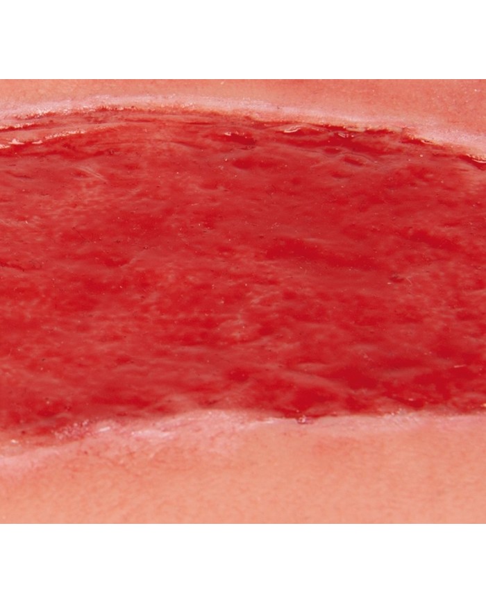 Moulage di ferita da ulcera arteriosa degli arti inferiori grande in fase