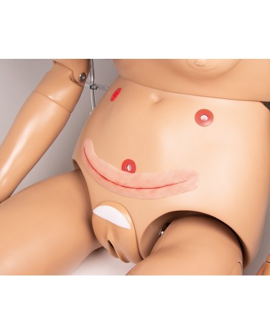 Moulage di ferita chirurgica senza sutura 22cm per auto sutura Erler Zim