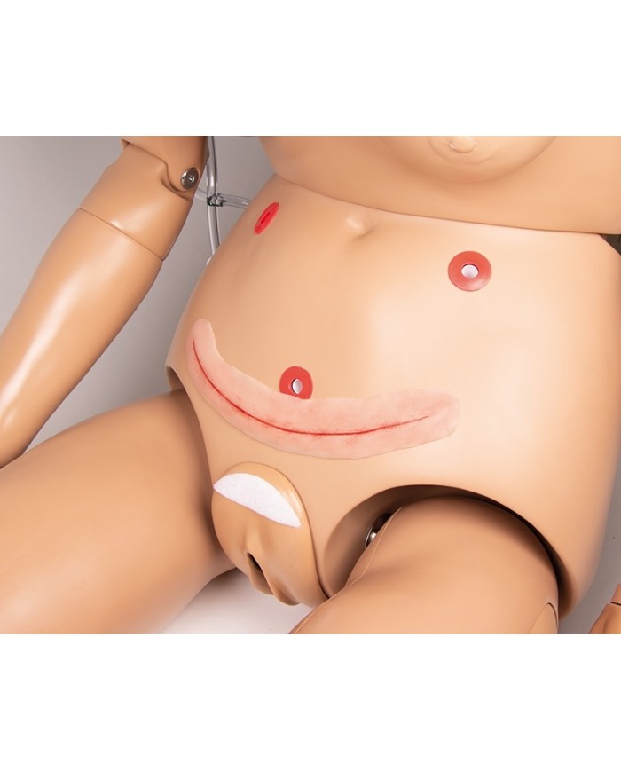 Moulage di ferita chirurgica senza sutura 22cm per auto sutura Erler Zim