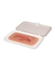 Moulage di ferita da ulcera arteriosa degli arti inferiori piccola in fas