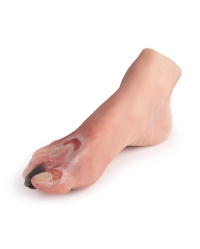 Piede diabetico con ferite Erler Zimmer PW006