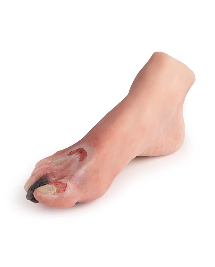 Piede diabetico con ferite Erler Zimmer PW006