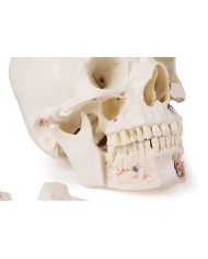 Cranio di lusso per studi avanzati in 14 parti Erler Zimmer 4800