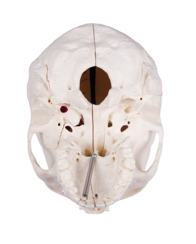 Cranio di lusso per studi avanzati in 14 parti Erler Zimmer 4800