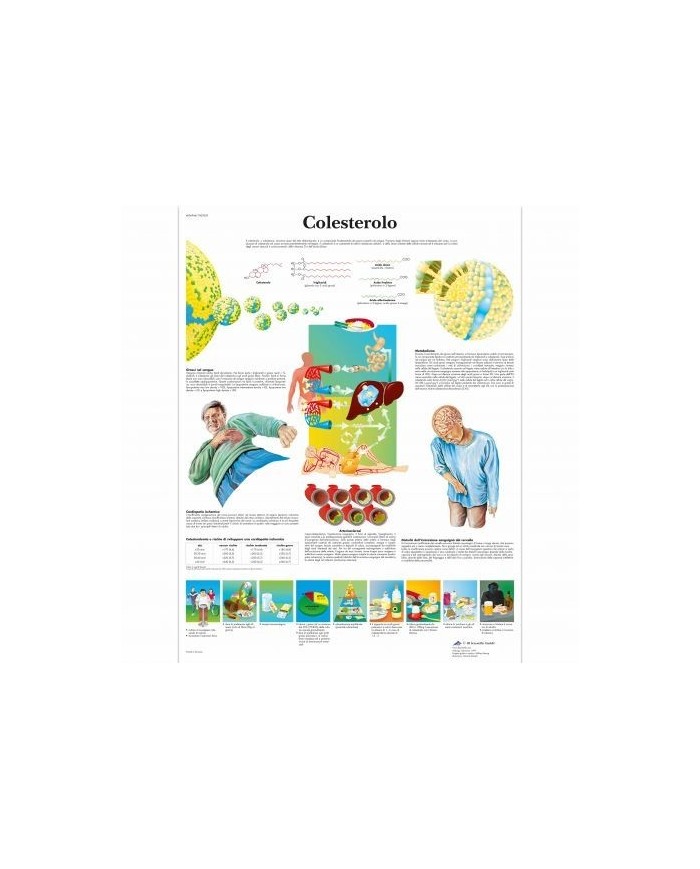 3B Scientific tavola anatomica Colesterolo cod VR4452L 