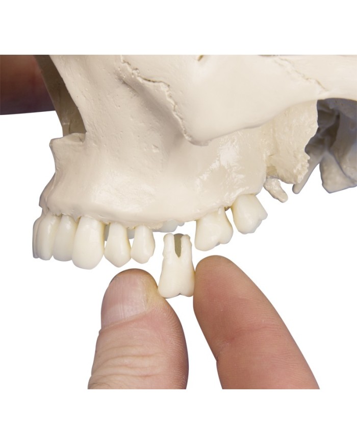 Erler Zimmer, modello anatomico di cranio per dentisti ed ortodonzia in 4 parti 4513