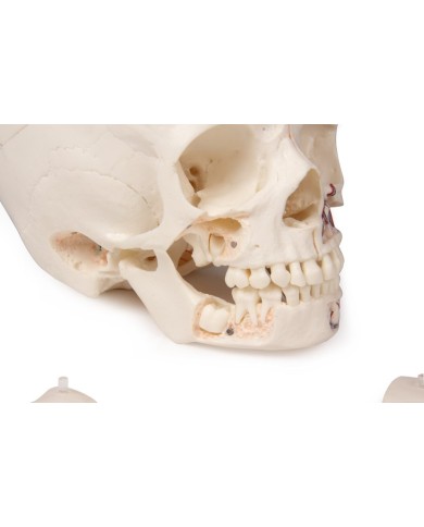 Cranio bambino di lusso per studi avanzati in 14 parti Erler Zimmer 4810