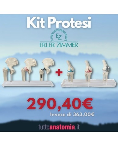 Kit articolazioni dell'anca e del ginocchio con protesi Kit articolazioni dell'anca e del ginocchio con protesi