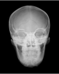Simulatore per radiologia Cranio radiografico con ossa artificiali Opac