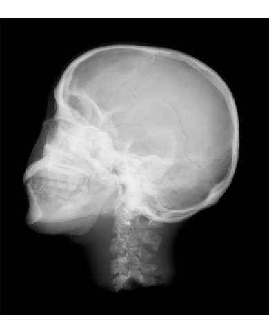 Simulatore per radiologia Cranio radiografico con ossa artificiali Opac