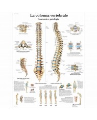 3B Scientific, tavola anatomica, La colonna vertebrale, anatomia e patologia (cod, VR4152UU)