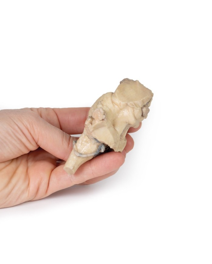 Tronco cerebrale anatomia isolata dal mesencefalo al midollo allungato E Tronco cerebrale anatomia isolata dal mesencefalo al midollo allungato E