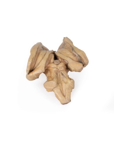 Tronco encefalico strutture cerebrali profonde e diencefaliche Erler Zim