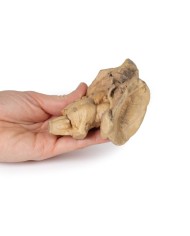 Tronco encefalico strutture cerebrali profonde e diencefaliche Erler Zim