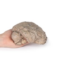 Emisezione cerebrale Erler Zimmer 3D anatomy Series MP1102