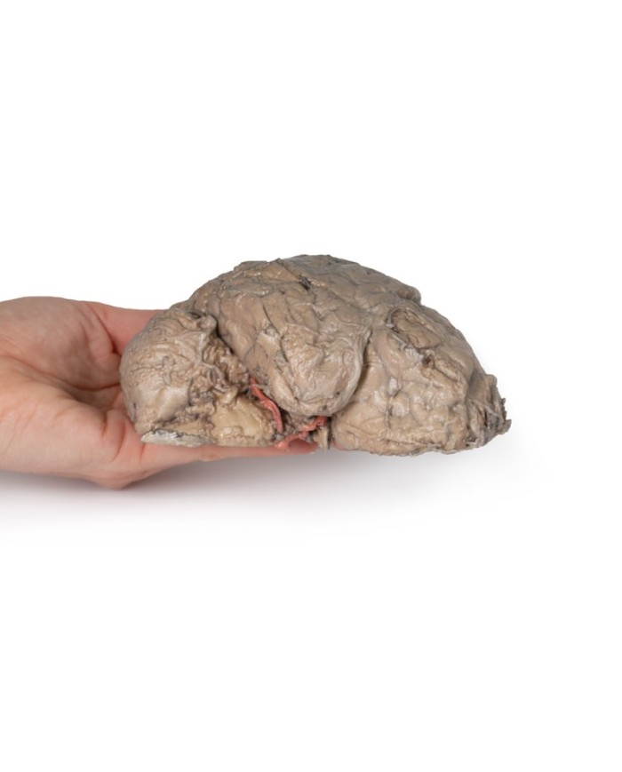 Emisezione cerebrale Erler Zimmer 3D anatomy Series MP1102