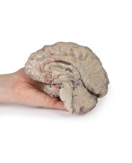 Emisezione cerebrale Erler Zimmer 3D anatomy Series MP1102