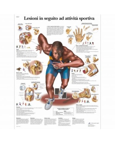 3B Scientific, tavola anatomica, Lesioni in seguito ad attività sportiva (cod, VR4188UU) 3B Scientific, tavola anatomica, Lesioni in seguito ad attività sportiva (cod, VR4188UU)